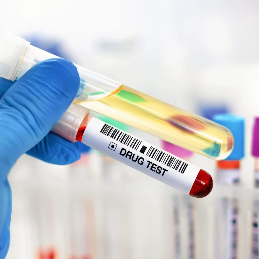 Hand doctor holding urine and blood tube test for analysis for doping or drugs. Doctor's hand with urinalysis and blood sample for drug test or alcohol in the laboratory